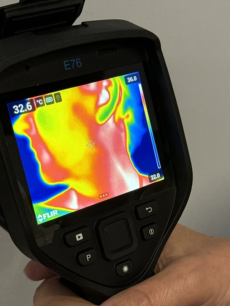 Termogram kliniczny — obszar kręgosłupa