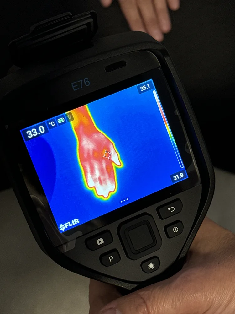 Termogram kliniczny — przykład diagnostyczny