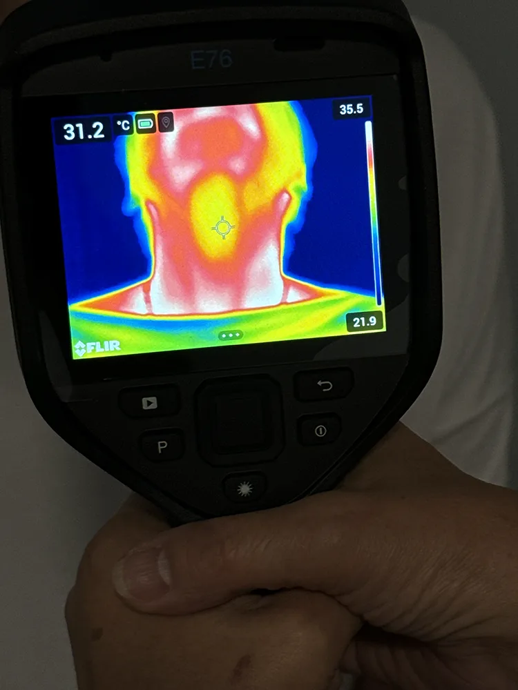 Termogram kliniczny — rozkład temperatury ciała