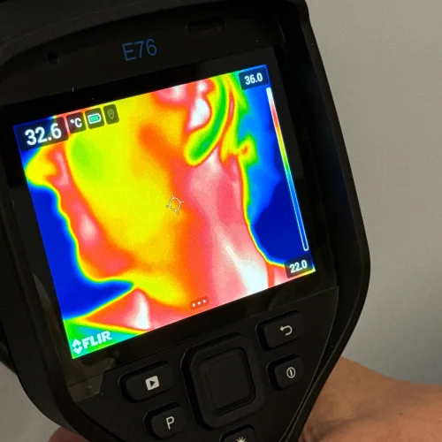 Kliniczny obraz termograficzny — przykład diagnostyczny rozkładu temperatury